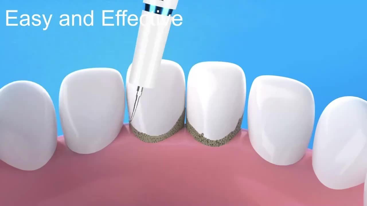 Valentines Day Electric Flosser Teeth Cleaner with 3 Replacement Heads and 5 Modes LED Light for Deep Cleaning Family Couples and Travel